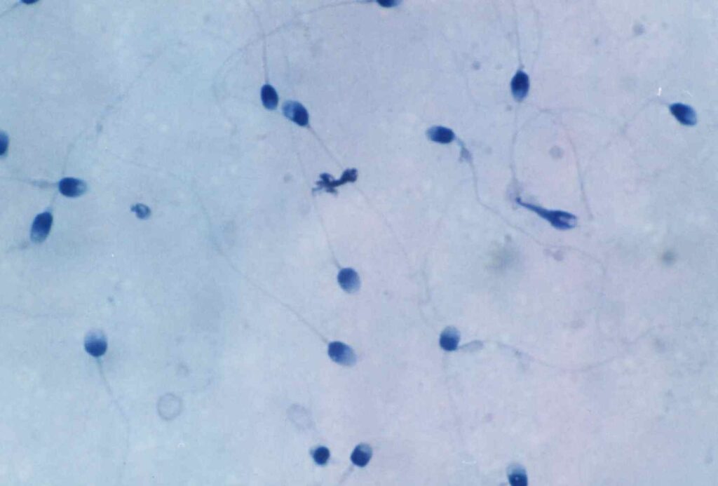 Light microscopy image of sperm cells used for semen quality assessment in an assisted reproduction laboratory.